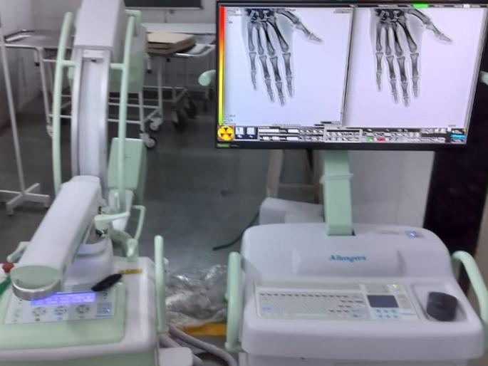 Nagpur referral volume for bone related surgery will stop | हाडांशी संबंधित शस्त्रक्रियेसाठी नागपूर रेफरचे प्रमाण थांबणार Nagpur referral volume for bone related surgery will stop | हाडांशी संबंधित शस्त्रक्रियेसाठी नागपूर रेफरचे प्रमाण थांबणार