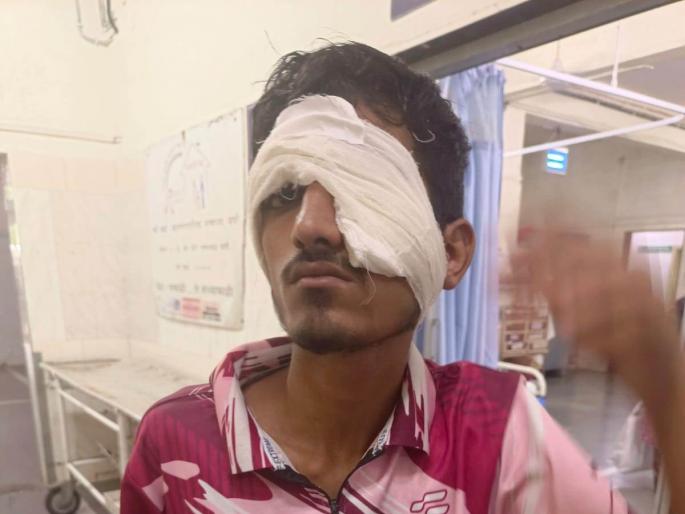 Passenger boy injured in stone pelting on local, hit eye | लोकल वर दगडफेकीत प्रवाशी मुलगा जखमी, डोळ्याला मार Passenger boy injured in stone pelting on local, hit eye | लोकल वर दगडफेकीत प्रवाशी मुलगा जखमी, डोळ्याला मार