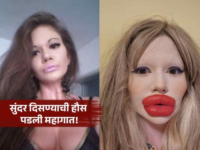 andrea ivanova worlds biggest lips spends 20000 euros doctors refuse | बाई हा काय प्रकार? लिप फिलरने हवा होता एकदम ग्लॅमरस लूक, पण ओठ इतके सुजले की...