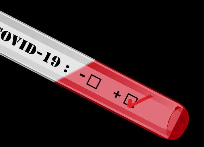 Another 27 corona positive patients were found in Akola district | अकोला जिल्ह्यात आणखी २७ कोरोना पॉझिटिव्ह रुग्ण आढळले