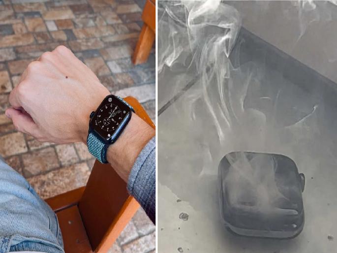 Apple Watch Blast | apple watch battery heated up and exploded claims | Apple Watch Blast: मोबाईल आणि टीव्हीनंतर आता Apple Watchचा स्फोट? गरम होऊन फुटल्याचा युजरचा दावा... Apple Watch Blast | apple watch battery heated up and exploded claims | Apple Watch Blast: मोबाईल आणि टीव्हीनंतर आता Apple Watchचा स्फोट? गरम होऊन फुटल्याचा युजरचा दावा...