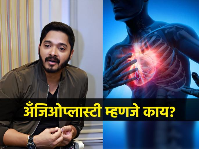 Shreyas Talpade Suffers Heart Attack Undergoes Angioplasty Know What is Angioplasty | हार्ट अटॅकनंतर श्रेयस तळपदेची तातडीने करावी लागली अँजिओप्लास्टी, हा उपचार नक्की असतो काय?