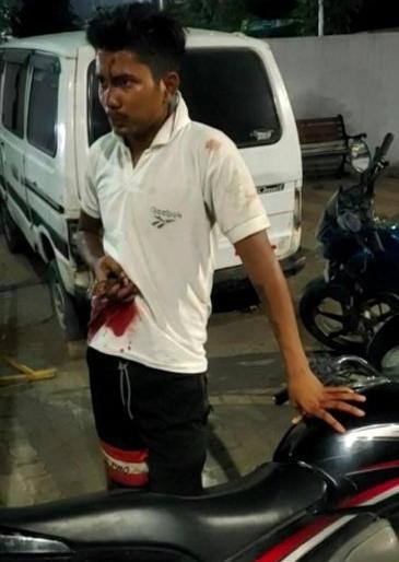 He reached the police station with a knife in his stomach | तो पोटात चाकू घेऊन पोहचला पोलीस ठाण्यात He reached the police station with a knife in his stomach | तो पोटात चाकू घेऊन पोहचला पोलीस ठाण्यात