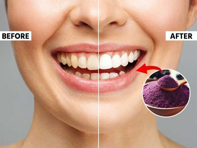 ayurvedic tooth powder for teeth whitening natural teeth whitening ayurveda tips how to whiten teeth naturally at home | रोज ब्रश करूनही दात पिवळेच? १० रुपये खर्च, घरीच करा आयुर्वेदिक दंतमंजन - पांढऱ्याशुभ्र दातांची चमक राहील कायम...