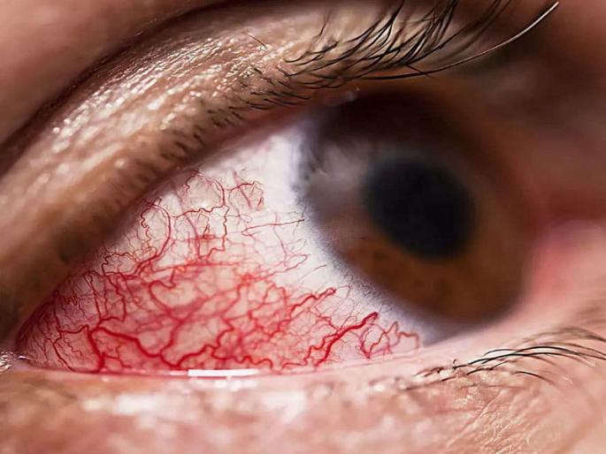 Shocking! Woman dies after successful surgery for myocardial infarction in Baramati | ...त्या रुग्णाचा मृत्य कोरोनामुळेच! आरोग्य विभागाचे स्पष्टीकरण