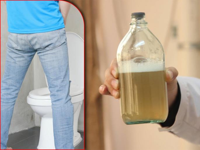 Foamy urine is the symptom of protein in urine problem that can indicate kidney and heart disease | लघवीमध्ये फेस येत असेल तर वेळीच व्हा सावध, या लक्षणांकडे करू नका दुर्लक्ष