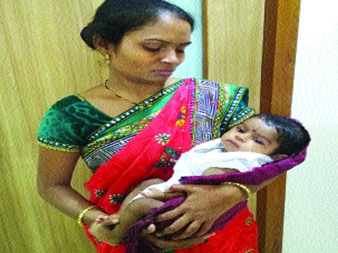 Successful surgery with 'Blue Baby' support | ‘ब्लू बेबी’ समर्थवर यशस्वी शस्त्रक्रिया Successful surgery with 'Blue Baby' support | ‘ब्लू बेबी’ समर्थवर यशस्वी शस्त्रक्रिया