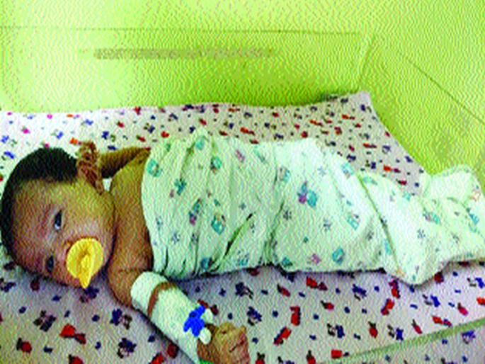 Needle in the baby's stomach of 22 days | २२ दिवसांच्या बाळाच्या पोटात सुई Needle in the baby's stomach of 22 days | २२ दिवसांच्या बाळाच्या पोटात सुई