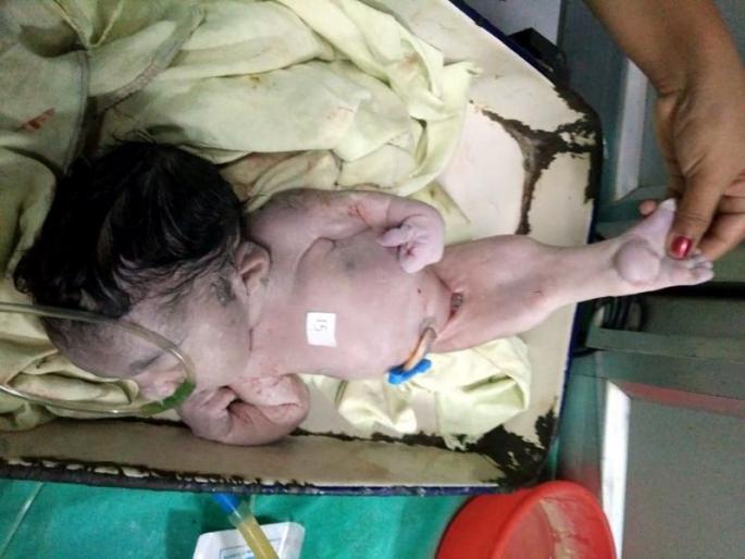 Fisheries are childlike short lived | मत्स्य सदृश्य बाळ ठरले अल्पायुषी Fisheries are childlike short lived | मत्स्य सदृश्य बाळ ठरले अल्पायुषी