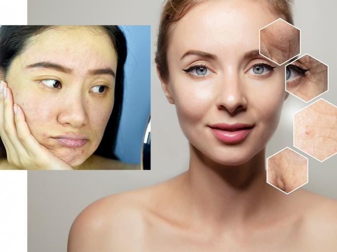Skin care Tips: Say bye to wrinkles on the face; 1 remedy- wrinkle leave | Skin care Tips : चेहऱ्यावरच्या सुरकुत्यांना म्हणा बाय; 1 उपाय- सुरकुत्यांना सुटी