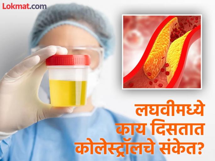 These 3 signs in urine indicates high level of bad Cholesterol in the body | लघवीमध्ये दिसतात शरीरात बॅड कोलेस्ट्रॉल वाढल्याचे 'हे' ३ संकेत, दुर्लक्ष करणं पडेल महागात These 3 signs in urine indicates high level of bad Cholesterol in the body | लघवीमध्ये दिसतात शरीरात बॅड कोलेस्ट्रॉल वाढल्याचे 'हे' ३ संकेत, दुर्लक्ष करणं पडेल महागात