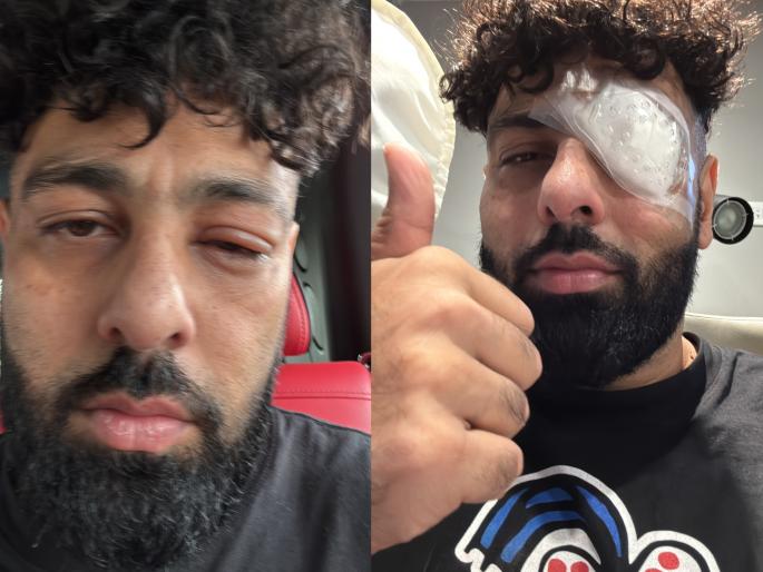 badshah injured his eye during chicago concert posts photo with bads of bollywood reference caption | "डोळ्याला सूज, बांधली पट्टी...", शिकागो येथील कॉन्सर्टवेळी रॅपर बादशाहला गंभीर दुखापत