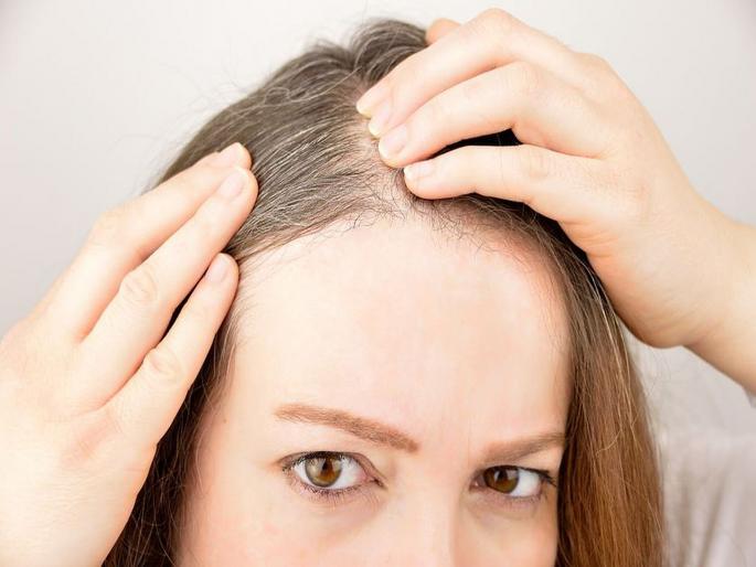 Black pepper promotes hair growth and stops pre mature graying | पांढरे केस आणि डॅंड्रफची समस्या दूर करण्यासाठी करा 'हा' घरगुती उपाय Black pepper promotes hair growth and stops pre mature graying | पांढरे केस आणि डॅंड्रफची समस्या दूर करण्यासाठी करा 'हा' घरगुती उपाय