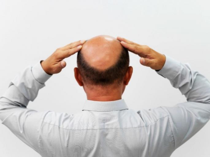 Why is hair suddenly falling out Number of bald people reaches 51 Door-to-door survey begins | अचानक कशामुळे गळताहेत केस? टक्कल पडणाऱ्यांची संख्या ५१ वर! घरोघरी सर्वेक्षण सुरू Why is hair suddenly falling out Number of bald people reaches 51 Door-to-door survey begins | अचानक कशामुळे गळताहेत केस? टक्कल पडणाऱ्यांची संख्या ५१ वर! घरोघरी सर्वेक्षण सुरू