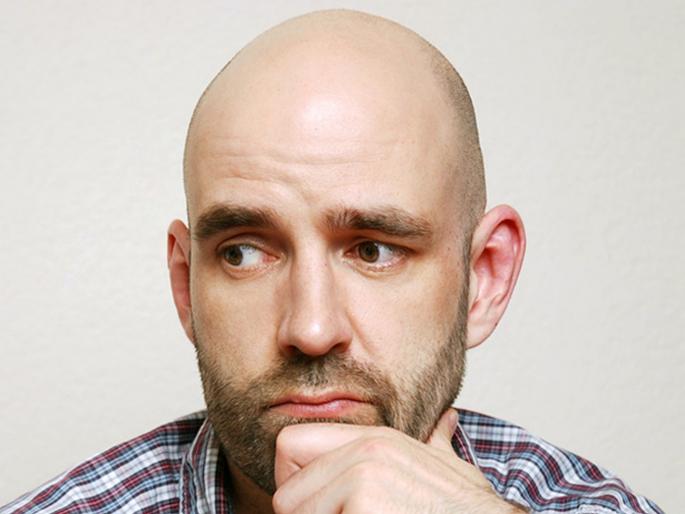 A hat that zaps the scalp could helps reverse male balding | टक्कल पडल्याने असाल हैराण तर चिंता सोडा, 'या' उपकरणाने दूर होईल तुमची समस्या... A hat that zaps the scalp could helps reverse male balding | टक्कल पडल्याने असाल हैराण तर चिंता सोडा, 'या' उपकरणाने दूर होईल तुमची समस्या...