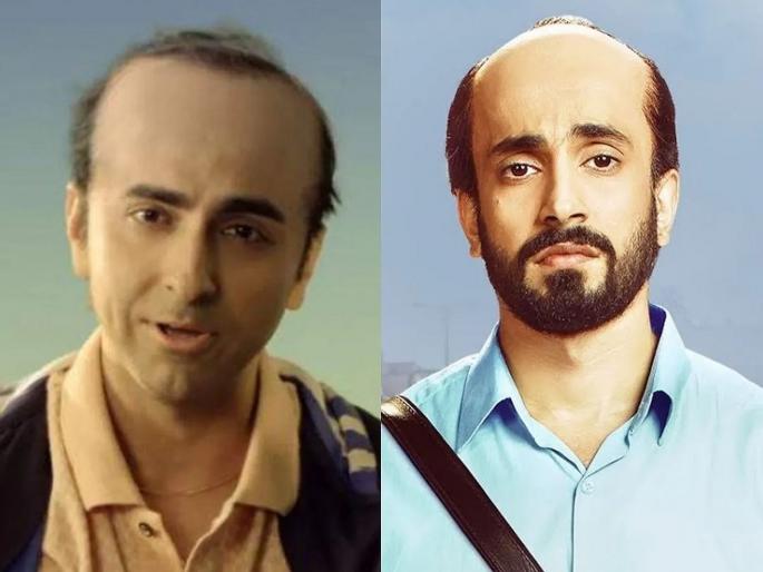Know why hair loss and baldness is more common in men | जास्तीत जास्त पुरूषांचं वाढत्या वयात टक्कल का पडतं? जाणून घ्या कारण... Know why hair loss and baldness is more common in men | जास्तीत जास्त पुरूषांचं वाढत्या वयात टक्कल का पडतं? जाणून घ्या कारण...