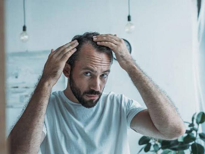 stop Hari loss by changing this habits | जीवशैलीतील या चुकांमुळे तुम्हाला टक्कल पडण्याची 'दाट' शक्यता, वेळीच करा हे उपाय stop Hari loss by changing this habits | जीवशैलीतील या चुकांमुळे तुम्हाला टक्कल पडण्याची 'दाट' शक्यता, वेळीच करा हे उपाय