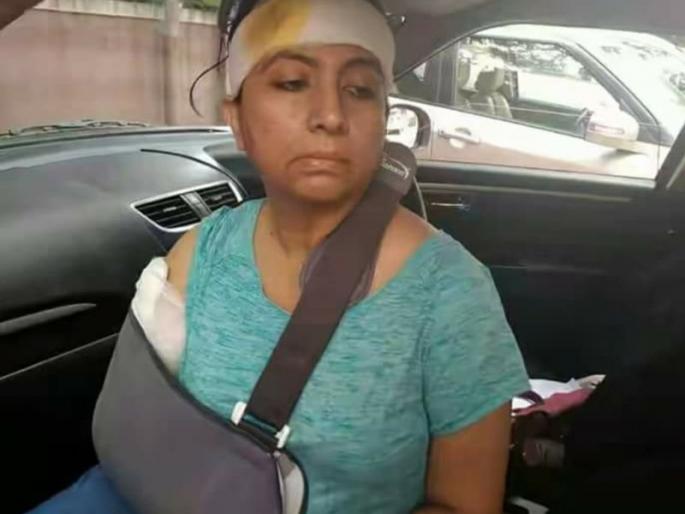 The mob attacked the woman trying to stop cow slaughter, throwing bricks and glass bottles | गोहत्या रोखण्याचा प्रयत्न करणा-या महिलेवरच जमावाने केला हल्ला, विटा आणि काचेच्या बाटल्या मारल्या फेकून The mob attacked the woman trying to stop cow slaughter, throwing bricks and glass bottles | गोहत्या रोखण्याचा प्रयत्न करणा-या महिलेवरच जमावाने केला हल्ला, विटा आणि काचेच्या बाटल्या मारल्या फेकून