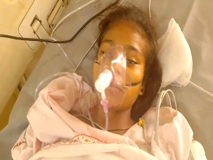 In UP's Bareilly, youths threw a girl in front of a train, 1 arm, 2 legs were lost forever | बर्थडेच्या दिवशी मुलीला मिळाली आयुष्यभराची वेदना; १ हात, २ पाय कायमचे गमावले In UP's Bareilly, youths threw a girl in front of a train, 1 arm, 2 legs were lost forever | बर्थडेच्या दिवशी मुलीला मिळाली आयुष्यभराची वेदना; १ हात, २ पाय कायमचे गमावले