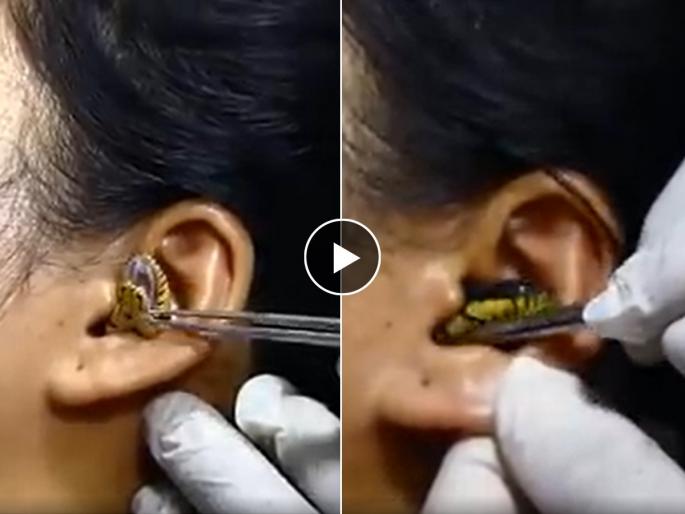 Snake Inside The Ear Shocking Footage Viral on Facebook : A snake entered In ear, the girl rushed to the doctor, viral video | कानात शिरला साप, मुलगी धावतच डॉक्टरकडे गेली पण...व्हायरल व्हिडिओ पाहून म्हणाल...