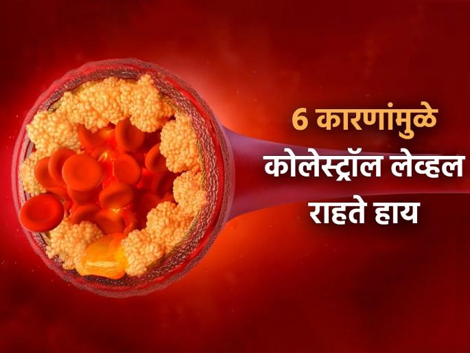 6 habits that keeps your cholesterol level high you can face heart attack | 6 कारणे ज्यांमुळे तुमची कोलेस्ट्रॉल लेव्हल राहते हाय, कधीही येऊ शकतो हार्ट अटॅक!
