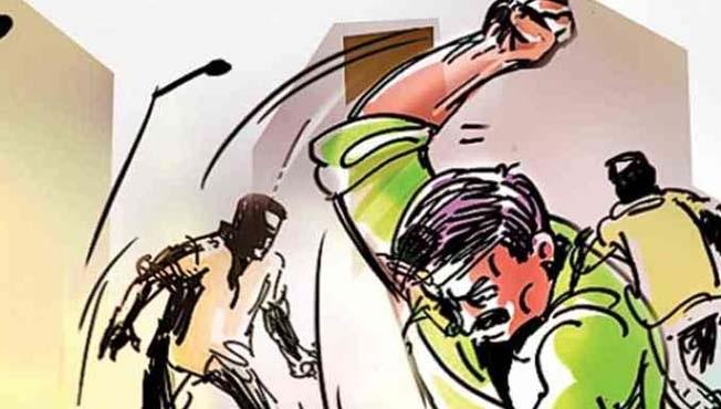 Shocking; Boiling water on the wife's face poured by the husband, know because | धक्कादायक; पतीनेच ओतले पत्नीच्या चेहऱ्यावर उकळते पाणी, जाणून घ्या कारण