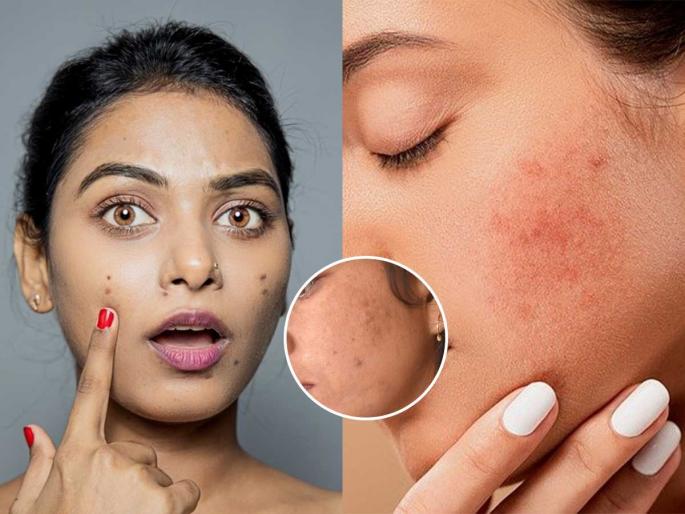 Check in the mirror to see if your face looks blemished. Follow these 5 steps to prevent your face from looking dull | आरशात पाहून तपासा की चेहरा डागाळलेला दिसतो का? चेहरा निस्तेज दिसू नये यासाठी करा हे ५ उपाय