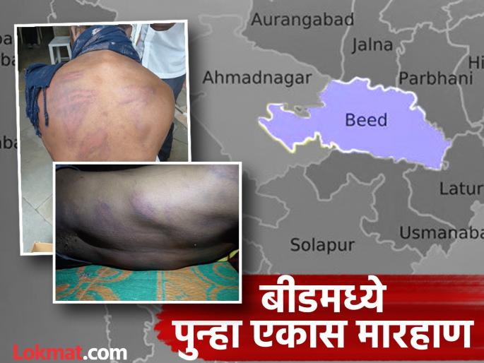 Beed Crime: Kidnapped and forced to drink alcohol on the pretext of drinking tea, then held and beaten for seven hours | Beed: चहा पिण्याच्या बहाण्याने अपहरण करून दारू पाजली, मग सात तास डांबून मारहाण Beed Crime: Kidnapped and forced to drink alcohol on the pretext of drinking tea, then held and beaten for seven hours | Beed: चहा पिण्याच्या बहाण्याने अपहरण करून दारू पाजली, मग सात तास डांबून मारहाण