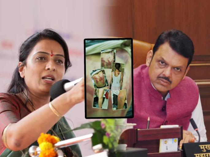 beed crime woman lawyer brutally beaten up for complaining complaint of dj noise Rohini Khadse slams CM Devendra Fadnavis | "मुख्यमंत्री महोदय, हे फोटो पाहूनही तुम्हाला झोप कशी लागते?"; रोहिणी खडसे यांचा संताप beed crime woman lawyer brutally beaten up for complaining complaint of dj noise Rohini Khadse slams CM Devendra Fadnavis | "मुख्यमंत्री महोदय, हे फोटो पाहूनही तुम्हाला झोप कशी लागते?"; रोहिणी खडसे यांचा संताप