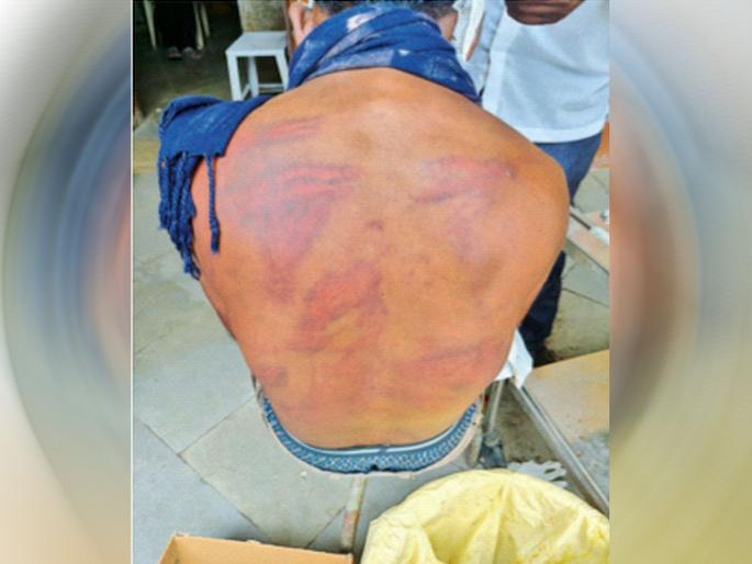 What's going on in Beed... Kidnapped, made to drink, then beaten like cattle for seven hours | बीडमध्ये चाललंय तरी काय... अपहरण करून दारू पाजली, मग सात तास गुरासारखे मारले What's going on in Beed... Kidnapped, made to drink, then beaten like cattle for seven hours | बीडमध्ये चाललंय तरी काय... अपहरण करून दारू पाजली, मग सात तास गुरासारखे मारले