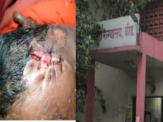 height of negligence; The patient was suffers due to indiscipline at Beed District Hospital | वेळीच पट्टी न केल्याने रुग्णाच्या जखमेत झाल्या आळ्या; बीड जिल्हा रुग्णालयात हलगर्जीपणाचा कळस height of negligence; The patient was suffers due to indiscipline at Beed District Hospital | वेळीच पट्टी न केल्याने रुग्णाच्या जखमेत झाल्या आळ्या; बीड जिल्हा रुग्णालयात हलगर्जीपणाचा कळस