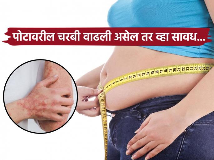 Belly fat can causes this serious disease claims news research | डायबिटीस- हृदयरोगामुळे नाही, पोटावरील चरबीनं होतो 'हा' गंभीर आजार; महिलांना अधिक धोका...
