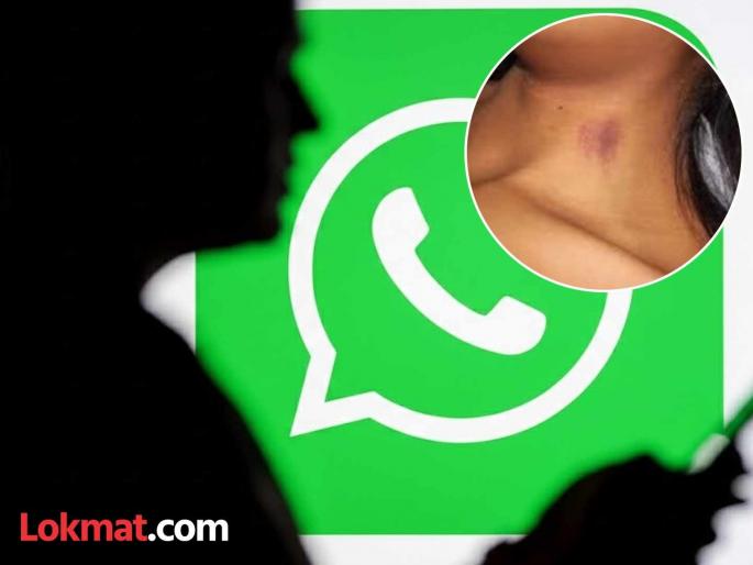 Bengaluru Gang rape hoax exposed Nursing student files false complaint to avoid boyfriend questions | मानेवरील 'लव्ह बाईट' लपवण्यासाठी मोठा बनाव; टॅक्सी चालकावर बलात्काराची खोटी तक्रार, CCTV ने वाचवले Bengaluru Gang rape hoax exposed Nursing student files false complaint to avoid boyfriend questions | मानेवरील 'लव्ह बाईट' लपवण्यासाठी मोठा बनाव; टॅक्सी चालकावर बलात्काराची खोटी तक्रार, CCTV ने वाचवले