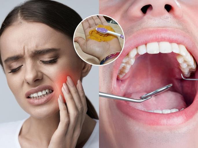 best home hacks for white teeth, how to get rid of toothache and yellow colour teeth, natural remedies for tooth cleaning  | चिमूटभर हळद घेऊन 'या' पद्धतीने ब्रश करा- दातांना किड लागणार नाही, मजबूत, पांढरेशुभ्र होतील