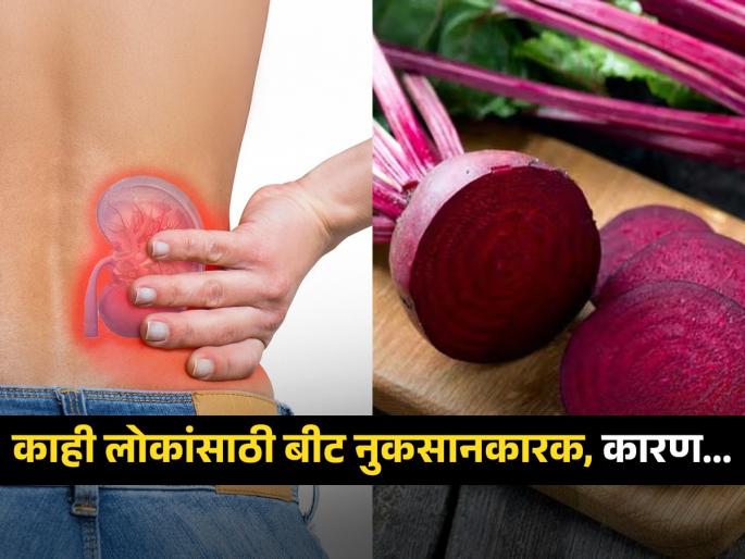 Why these people should avoid eating beetroot | स्वस्त सुपरफूड असलेलं बीट खाणं काहींसाठी ठरतं घातक, पाहा कुणी खावं-कुणी टाळावं..
