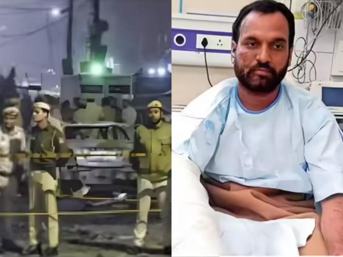 delhi blast injured peoples lives derail feeding families becomes challenge | Delhi Blast : "आता कुटुंबाचं पोट कसं भरणार?"; दिल्ली स्फोटातील जखमींची मन हेलावून टाकणारी गोष्ट delhi blast injured peoples lives derail feeding families becomes challenge | Delhi Blast : "आता कुटुंबाचं पोट कसं भरणार?"; दिल्ली स्फोटातील जखमींची मन हेलावून टाकणारी गोष्ट