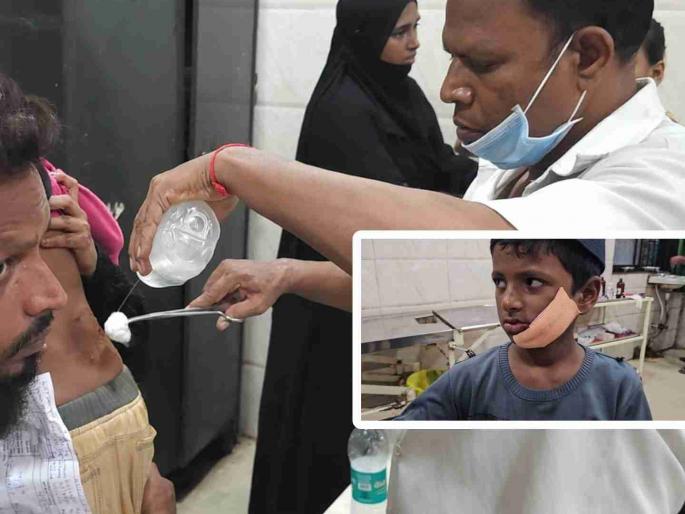 Haidos of a crushed dog in Bhiwandi; 25 to 30 people are bitten, including children  | भिवंडीत पिसाळलेल्या कुत्र्याचा हैदोस; २५ ते ३० जणांचा घेतला चावा, लहान मुलांचाही समावेश Haidos of a crushed dog in Bhiwandi; 25 to 30 people are bitten, including children  | भिवंडीत पिसाळलेल्या कुत्र्याचा हैदोस; २५ ते ३० जणांचा घेतला चावा, लहान मुलांचाही समावेश