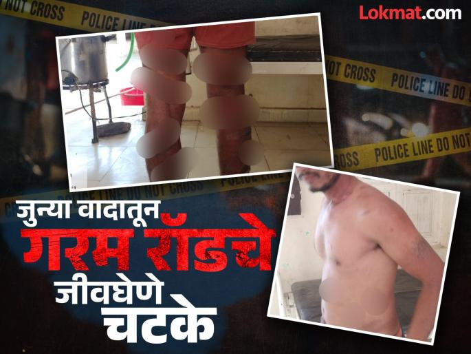 In Bhokardarn the old dispute was ignite again; Fatal torture of young man by beating him with hot rod | जुना वाद उकरून काढला; तरुणास गरम रॉडचे चटके देऊन जीवघेण्या यातना In Bhokardarn the old dispute was ignite again; Fatal torture of young man by beating him with hot rod | जुना वाद उकरून काढला; तरुणास गरम रॉडचे चटके देऊन जीवघेण्या यातना