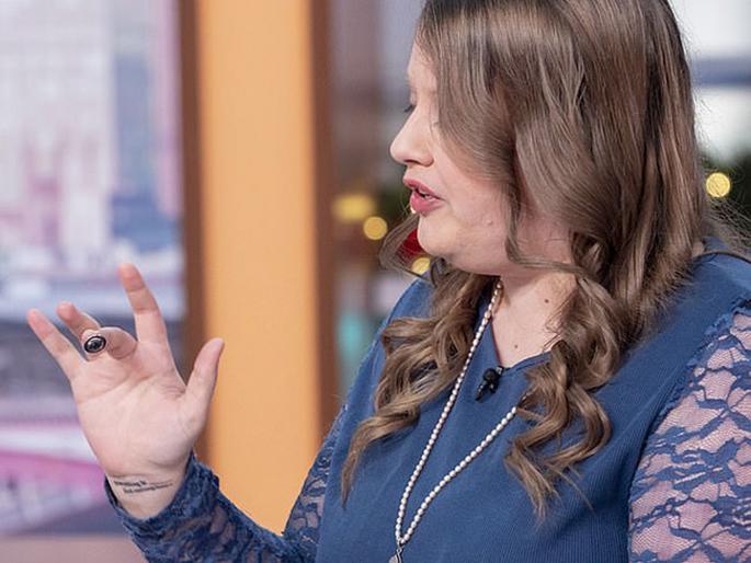 Bionic woman : 31 year old american engineer got microchip implants in her body | 'या' महिलेने शरीरावरच फिट केली घराची चावी आणि बिझनेस कार्ड, सोपं झालं म्हणते जीवन... 