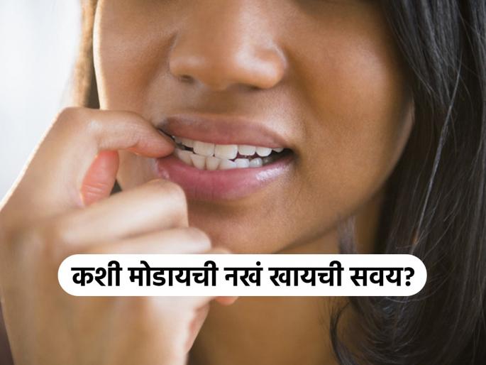 Biting your fingernails could spark extremely serious health risks, Harvard doctor warns. Here’s how to break the habit | तुम्हाला फावल्या वेळेत नखं खाण्याची सवय असेल तर आताच सोडा; डॉक्टरांचा धोक्याचा इशारा