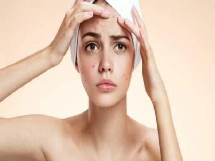 There is a home remedy for dark spots on the face, what is the need for expensive treatment? | चेहेऱ्यावरच्या काळ्या डागांसाठी महागड्या ट्रीटमेण्ट करताय? आधी हे वाचा, घरातल्या या ५ गोष्टी तुमचा प्रश्न सोडवू शकतात.