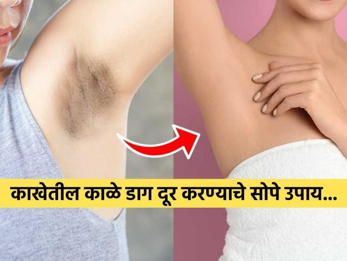 How to get rid of dark underarms home remedies | काखेतील काळे डाग घालवण्यासाठी अघोरी उपाय सोडा-त्रास वाढेल, ‘हे’ ३ उपाय-देतील मनासारखा रिझल्ट How to get rid of dark underarms home remedies | काखेतील काळे डाग घालवण्यासाठी अघोरी उपाय सोडा-त्रास वाढेल, ‘हे’ ३ उपाय-देतील मनासारखा रिझल्ट