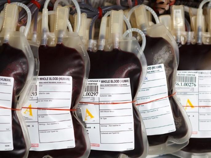 Sickle cell, thalassemia patients need 150 bags of blood per month | सिकलसेल, थॅलेसेमिया रुग्णांना महिन्याला हवे १५० बॅग रक्त Sickle cell, thalassemia patients need 150 bags of blood per month | सिकलसेल, थॅलेसेमिया रुग्णांना महिन्याला हवे १५० बॅग रक्त