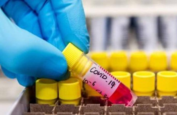 The number of reports pending in the laboratory increased | प्रयाेगशाळेत अहवाल प्रलंबित राहण्याचे प्रमाण वाढले The number of reports pending in the laboratory increased | प्रयाेगशाळेत अहवाल प्रलंबित राहण्याचे प्रमाण वाढले