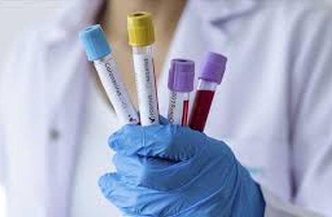 CoronaVirus: Increased patient growth in Buldana district; 24 patients in 16 days | CoronaVirus : बुलडाणा जिल्ह्यात रुग्ण वाढीचा वेग वाढला; १६ दिवसात २४ रुग्ण