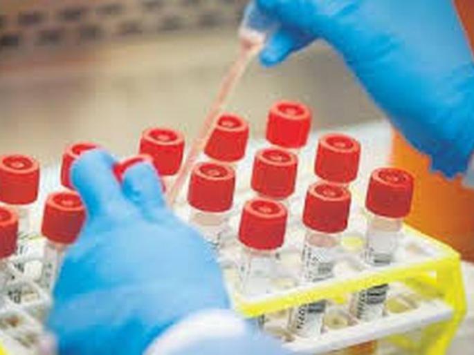 CoronaVirus in Buldhana: 55 more positive; 53 coronated | CoronaVirus in Buldhana : आणखी ५५ पॉझिटिव्ह; ५३ जण कोरोनामुक्त CoronaVirus in Buldhana: 55 more positive; 53 coronated | CoronaVirus in Buldhana : आणखी ५५ पॉझिटिव्ह; ५३ जण कोरोनामुक्त