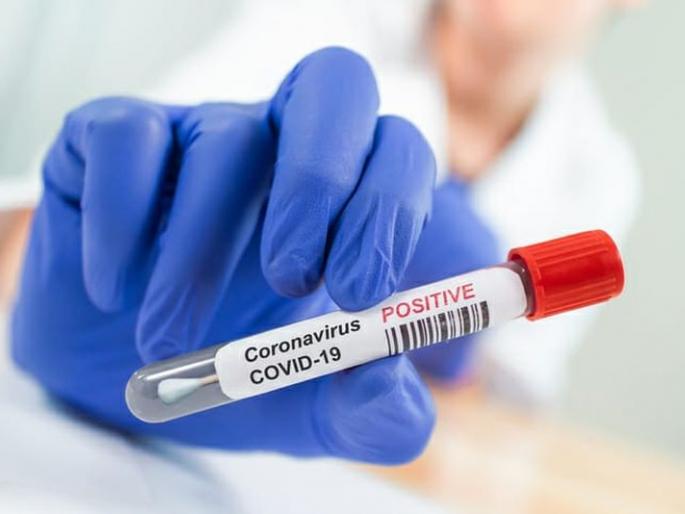 CoronaVirus in Akola: 36 more positive; The total number of patients is 663 | CoronaVirus in Akola : आणखी ३६ पॉझिटिव्ह; एकूण रुग्णसंख्या ६६३ वर CoronaVirus in Akola: 36 more positive; The total number of patients is 663 | CoronaVirus in Akola : आणखी ३६ पॉझिटिव्ह; एकूण रुग्णसंख्या ६६३ वर