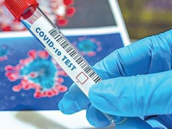 Another death in Buldana district; 802 corona positive | बुलडाणा जिल्ह्यात आणखी एकाचा मृत्यू; ८०२ कोरोना पॉझिटिव्ह