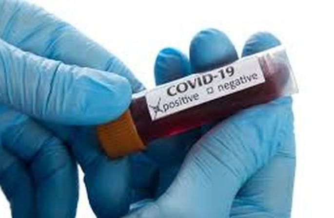 In Buldana district, 391 corona positive, 179 defeated | बुलडाणा जिल्हयात ३९१ कोरोना पॉझिटिव्ह, १७९ जणांची मात In Buldana district, 391 corona positive, 179 defeated | बुलडाणा जिल्हयात ३९१ कोरोना पॉझिटिव्ह, १७९ जणांची मात