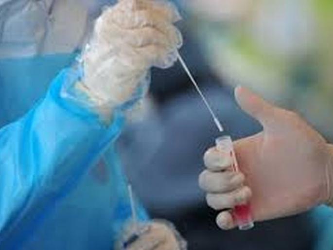 Another 427 positives in Buldana district, 354 beat corona | बुलडाणा जिल्ह्यात आणखी ४२७ पॉझिटिव्ह, ३५४ जणांची कोरोनावर मात